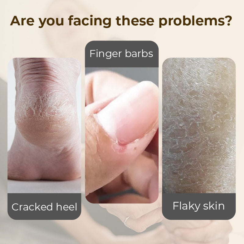 🎉Buy 2 Get 1 Free🎉Hydrating and Anti-Cracking Foot Cream