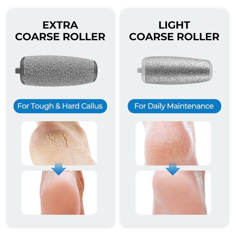 🔥Hot Sale - 50% OFF🔥Electric Feet Callus Remover⚡