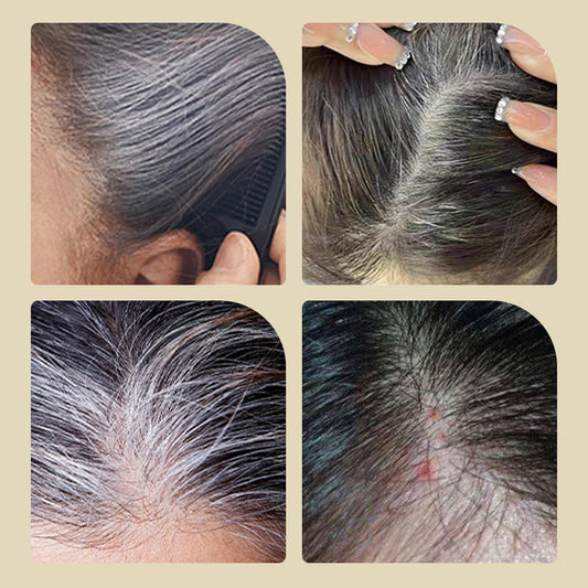 ⏳Limited-time 50% off⏰Safe and Convenient Comb Hair Dye