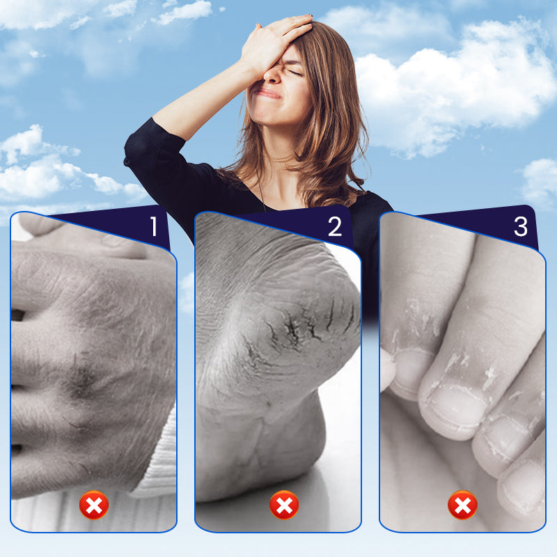 🩹 BUY 2 GET 1 FREE! ✨ Cracked Skin Repair Patch - Deep Hydration for Heels/Elbows, Pain Relief in 2 Hours, Invisible & Waterproof ⏳📦