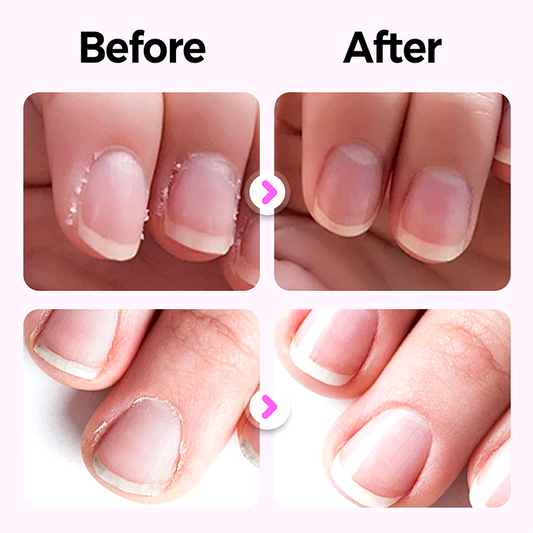 👍🧑‍⚕️Repairing Nail Damage✨ "Fragrance + manicure + armor" in ONE portable nail care pen💅