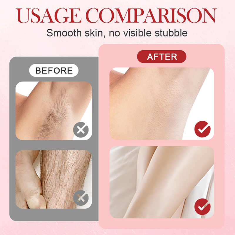 🔥Hot Sale Deals- Portable Dual-Head Electric Epilator